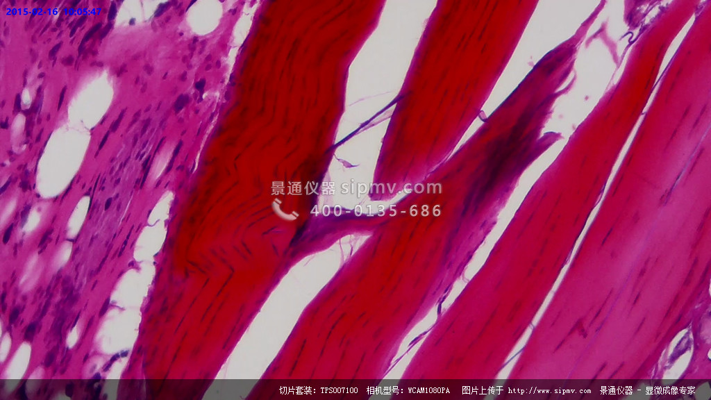 显微镜下的纤维结缔组织切片