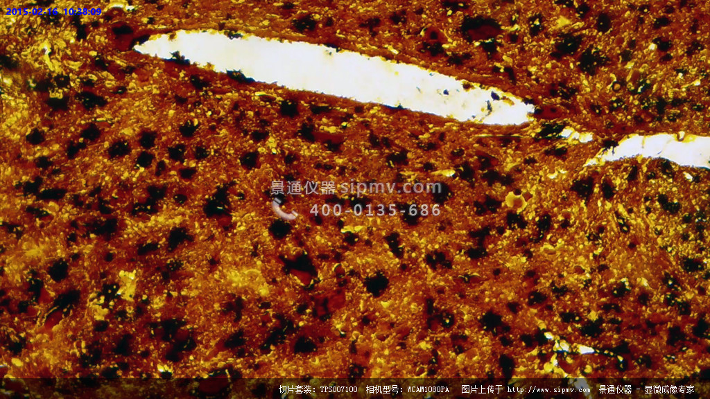 显微镜下的吐脊髓横切银染