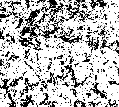 金相评级标准:淬回火屈氏体组织级别金相图谱(1-5级)